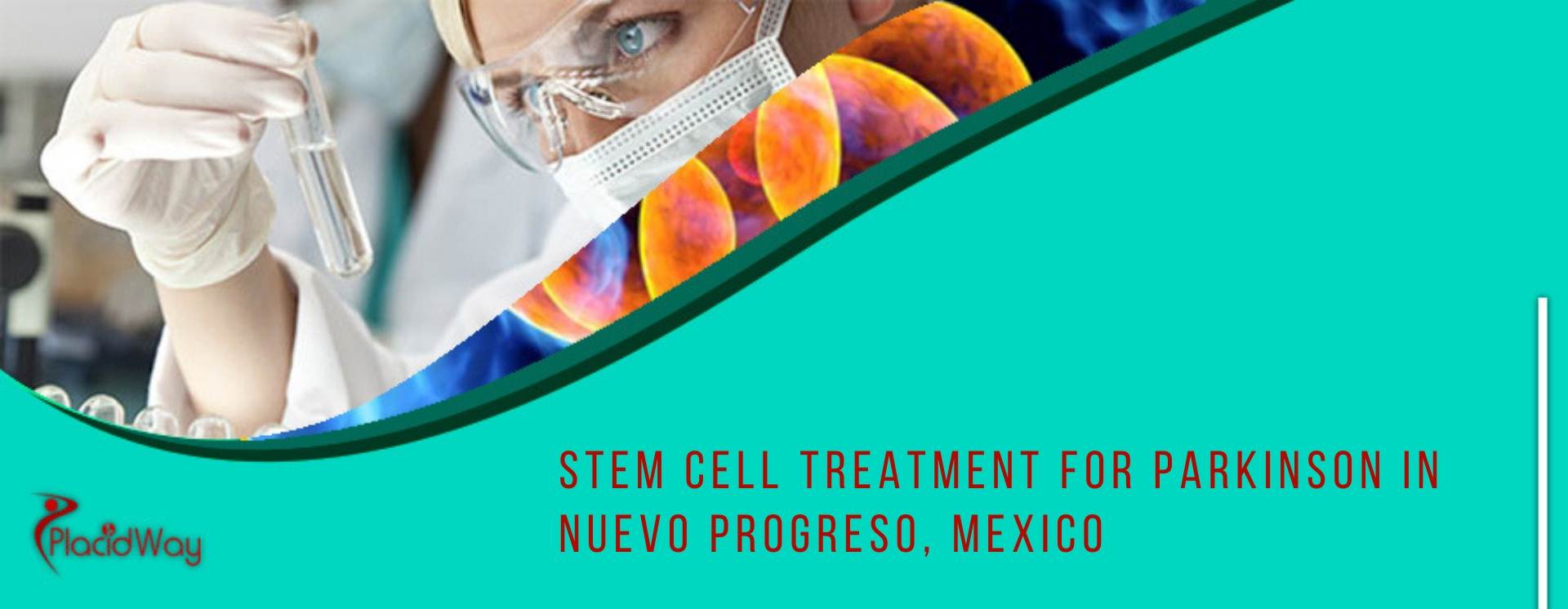 Stem Cell Treatment for Parkinson disease